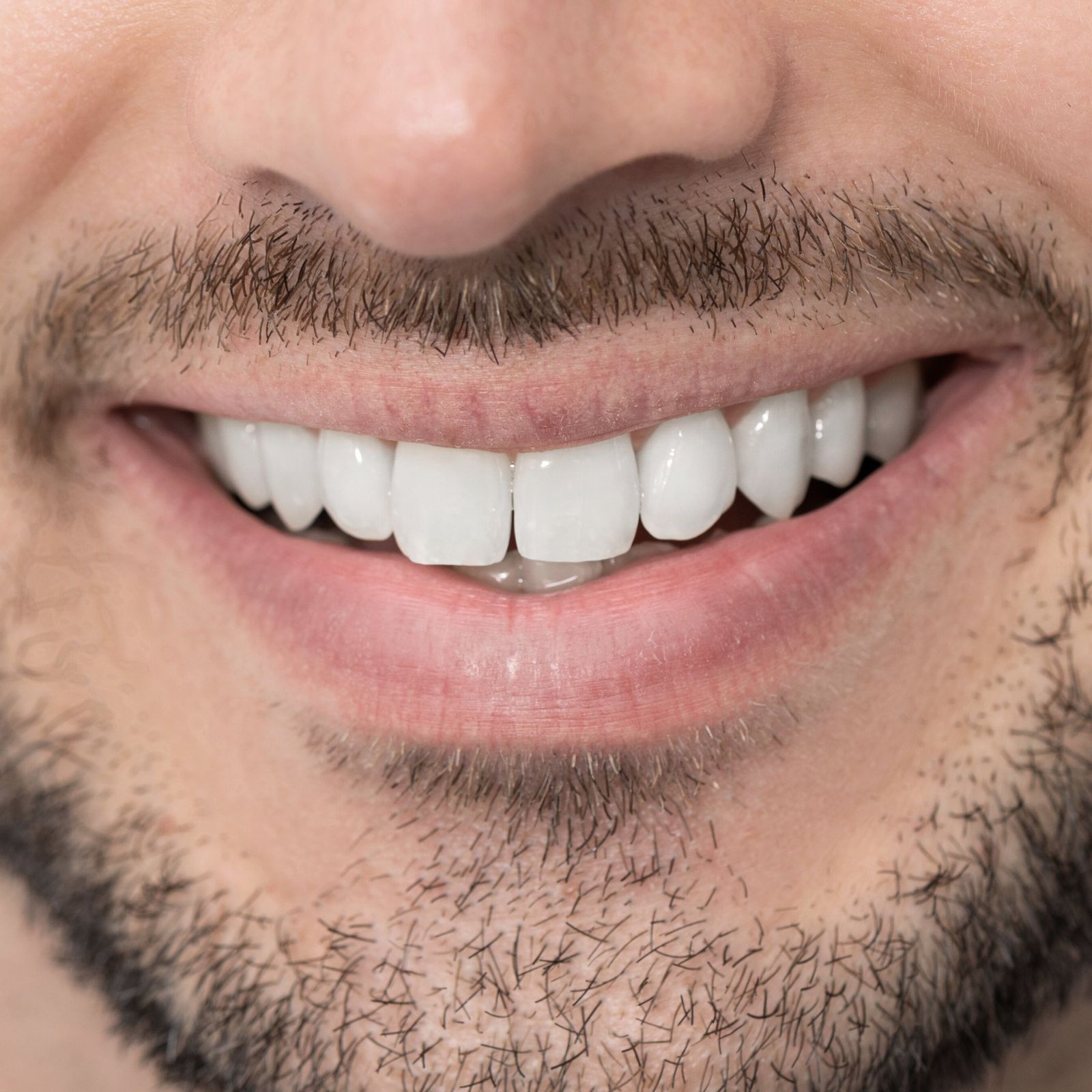 implantes-dentales-cunit