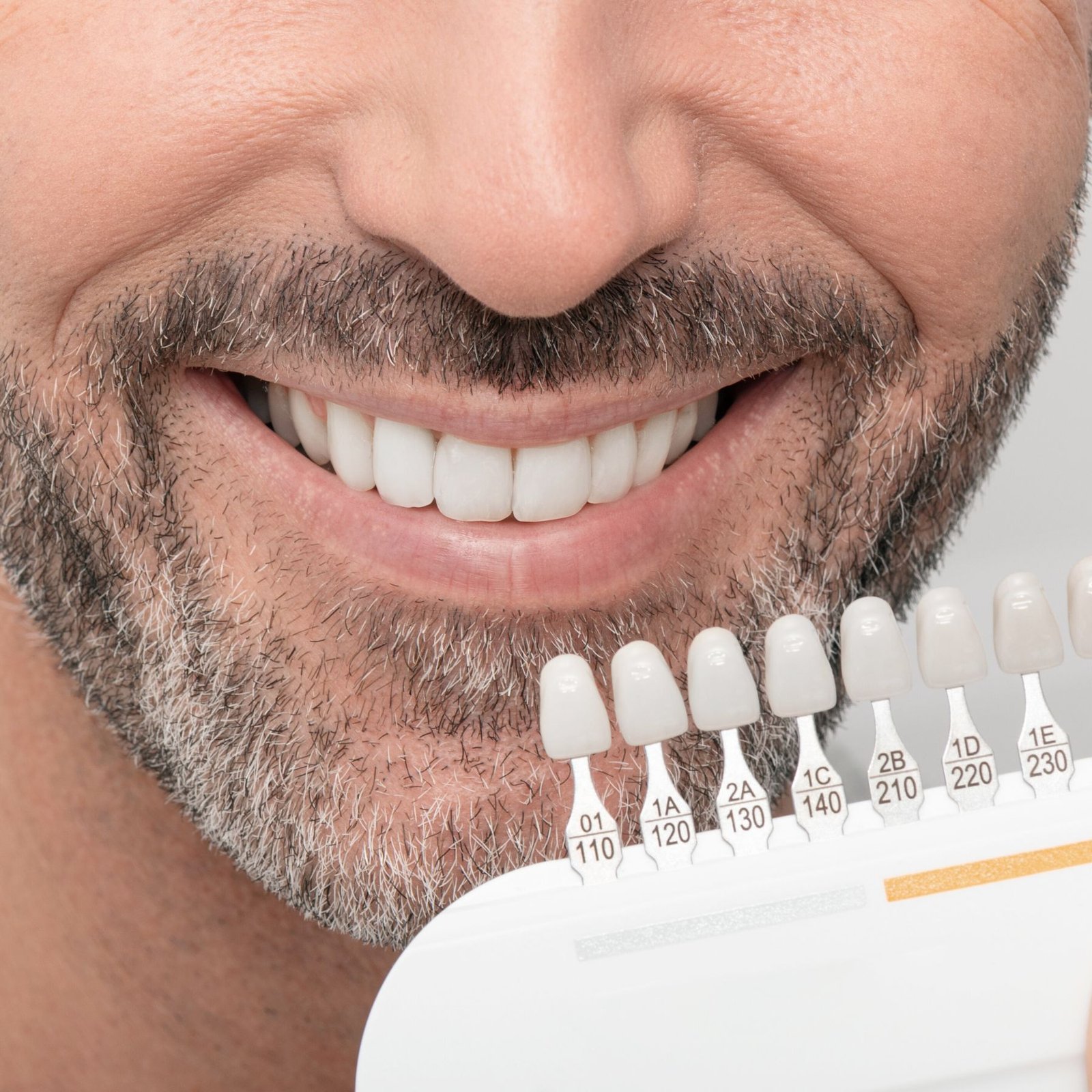 blanqueamiento-dental-en-cunit-tarragona