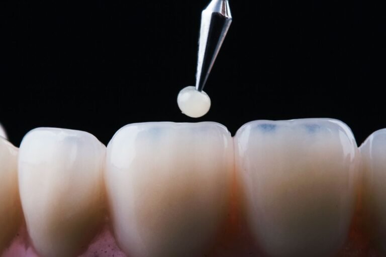 carillas-dentales-de-composite-en-cunit-tarragona