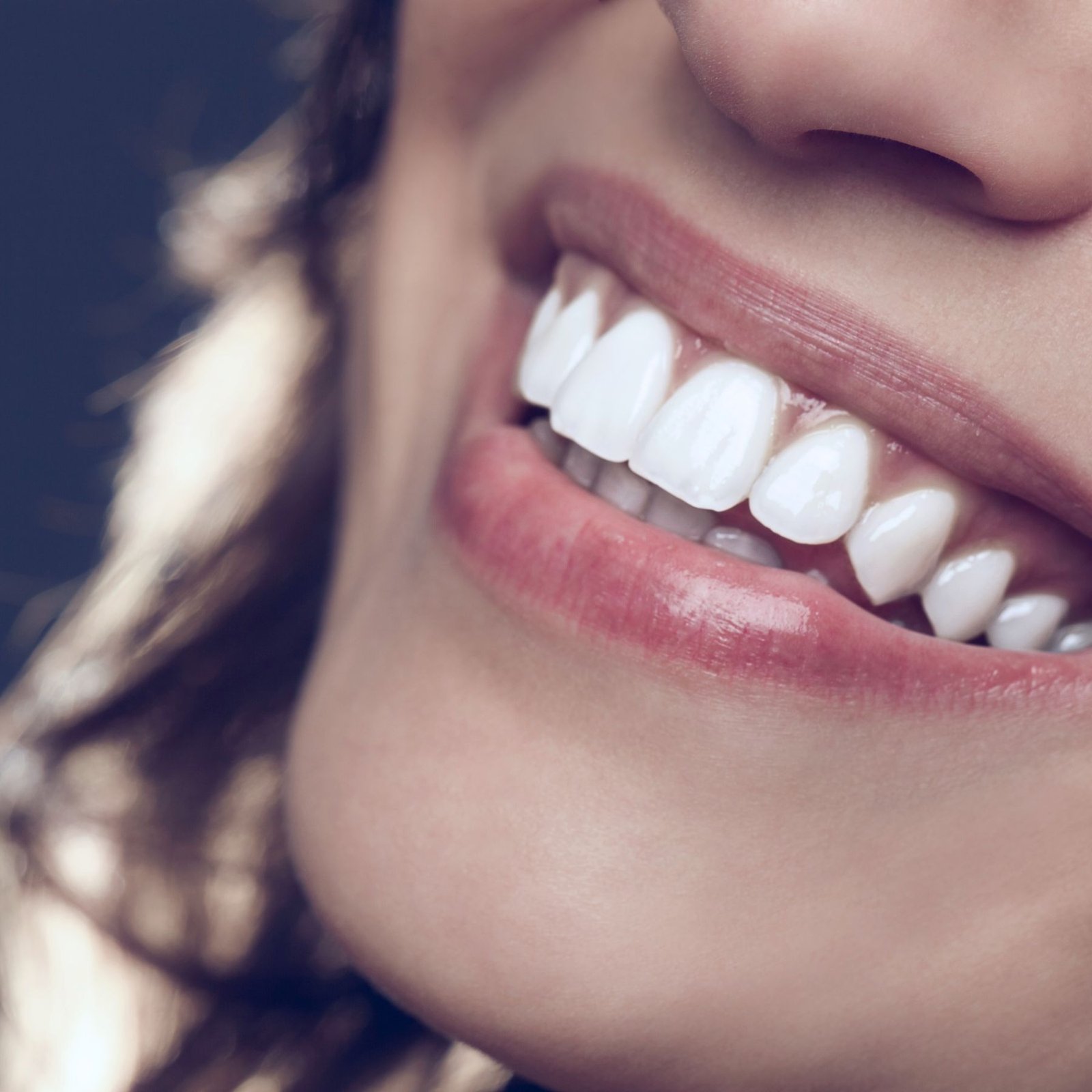 carillas-dentales-en-cunit-tarragona-clinica-area-salud